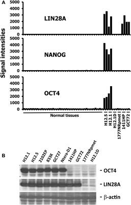 Differentiation-Dependent Regulation of Human Endogenous Retrovirus K Sequences and Neighboring Genes in Germ Cell Tumor Cells